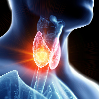 Thyroid & Athletes: What You Need to Know